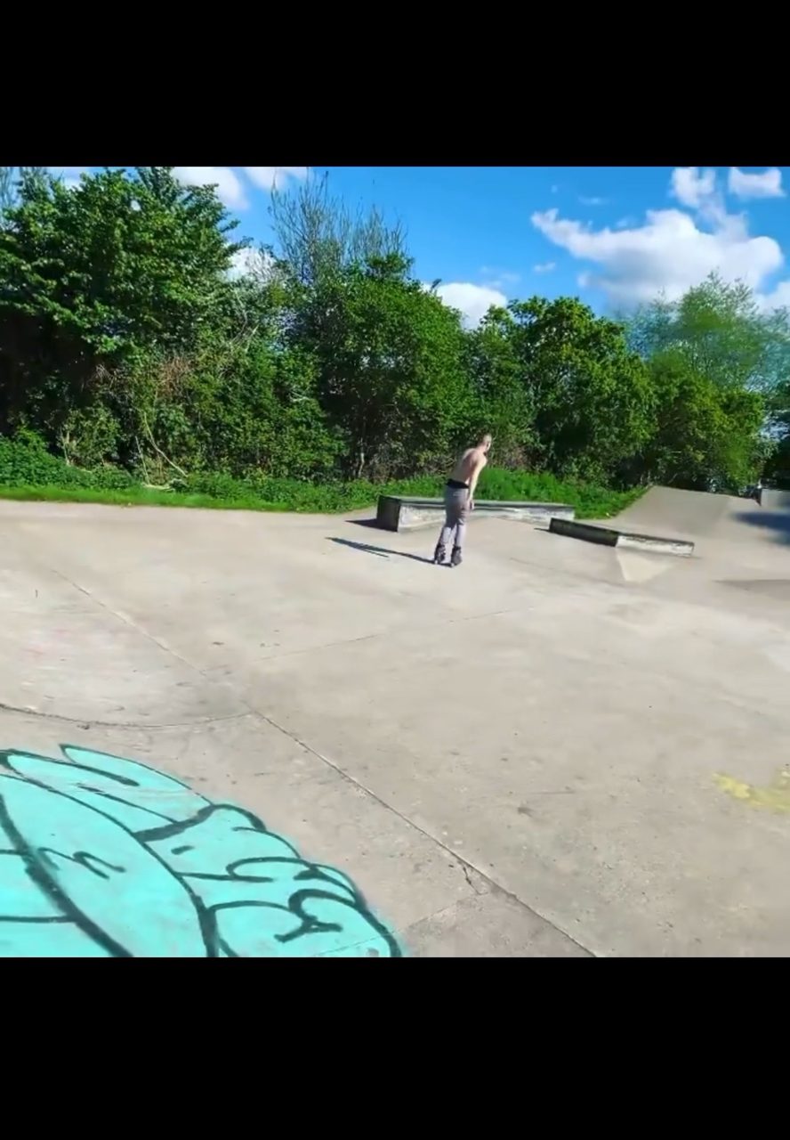 Day before a knee surgery. 😎😂 #trick #skatepark #crew #spot #session #city 