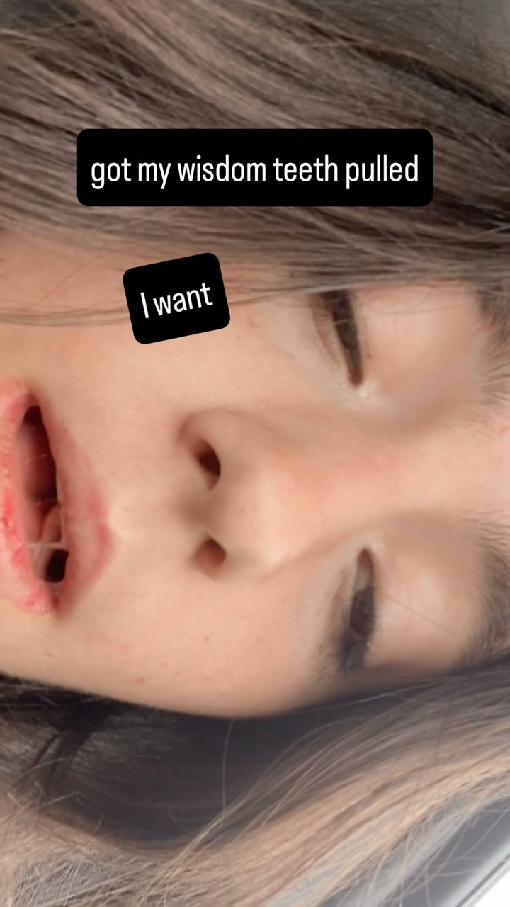 immediately after surgery: